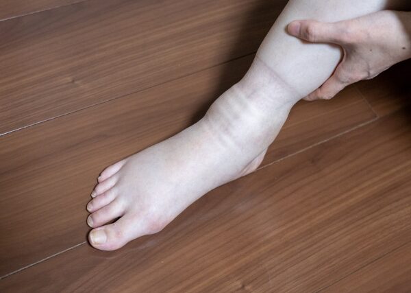 足が重い・だるい・むくむ… 「自律神経の乱れ」が関係する３つの理由