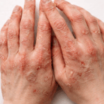 乾燥で手と指が限界…治らない本当の理由